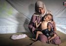 بلای جنگ و گرسنگی بر سر غزه/ تصاویری باور نکردنی از کودکان غزه که به سختی ۸ کیلو می‌شوند