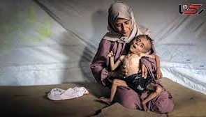 بلای جنگ و گرسنگی بر سر غزه/ تصاویری باور نکردنی از کودکان غزه که به سختی ۸ کیلو می‌شوند